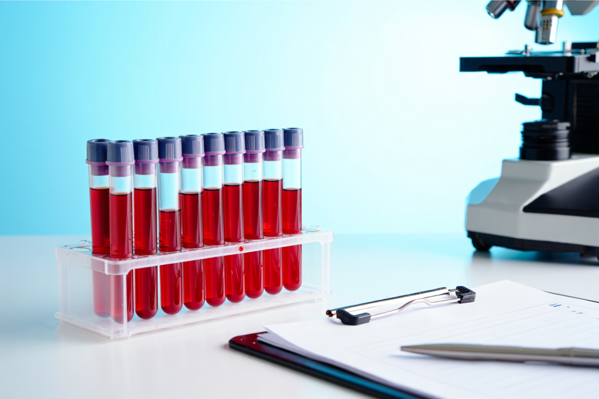 MCHC Blood Test: What It Reveals About Your Health