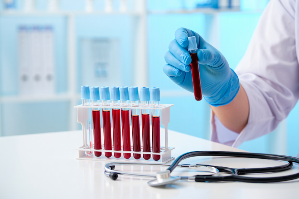 MCHC Blood Test: What It Reveals About Your Health